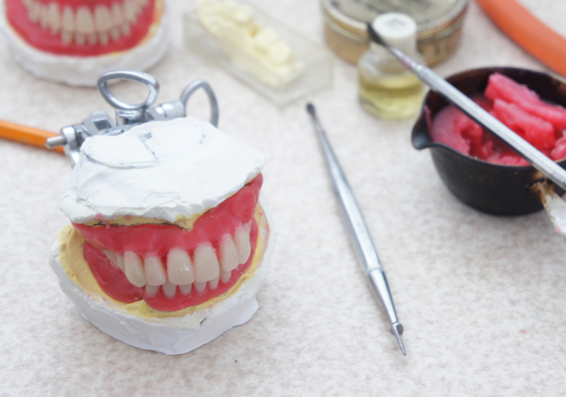 義歯（入れ歯）